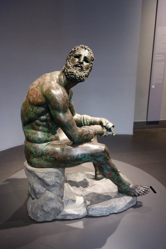 The Boxer's neck seems unnaturally long from this angle.
